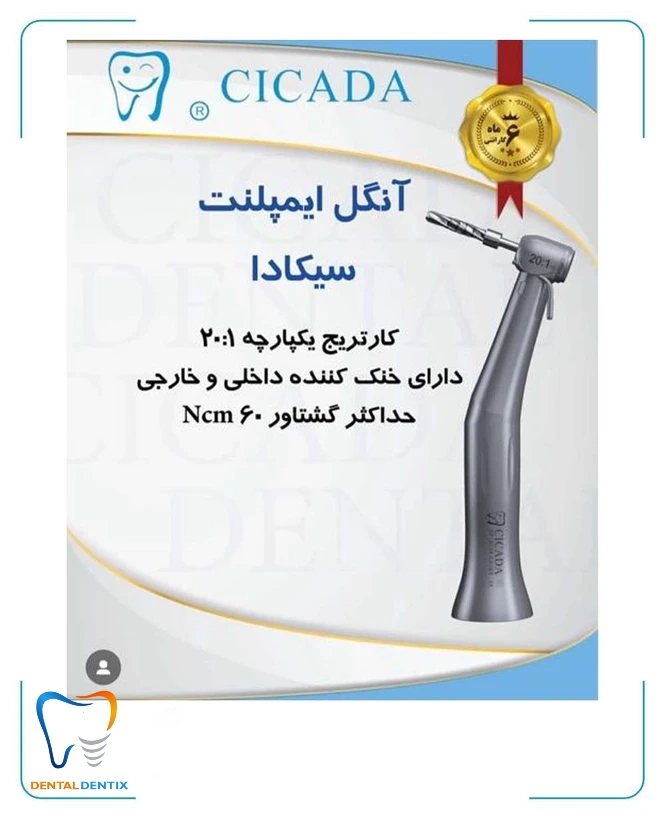 آنگل ایمپلنت سیکادا